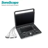 Hot sale brand Sonoscape ultrasound E2 portable ultrasound scanner