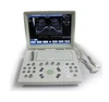 MSLPU33 Premium selected portable laptop ultrasound scanner / ultrasound machines sale