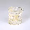 Primary dentition age 9 pediatric tooth model