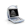 Uncompromized Mindray M5 color doppler ultrasound machine for obstetric and gynecology