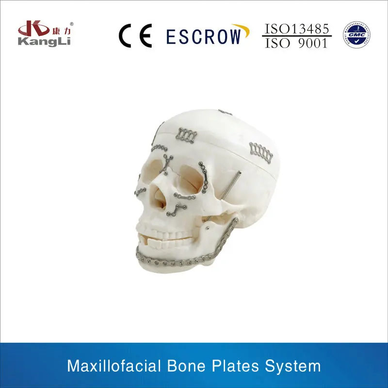 maxillofacial plates, orthopaedic implants manufacturer