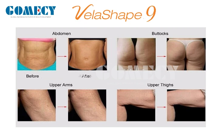 GOMECY 1000W RF+ BIO + 2*40 K cavitation + vacuum + IR + BIO velashape lipo laser body shape beauty machine.jpg
