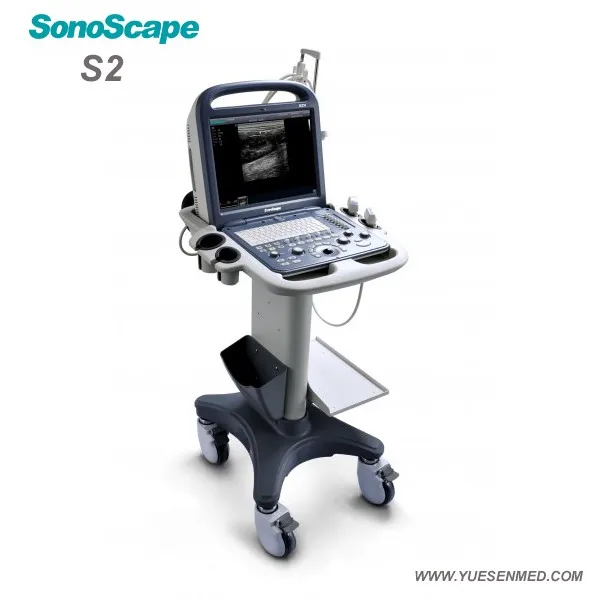 SonoScape ultrasound