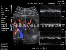 Portable Ultrasonic Diagnostic Devices Type Ultrasound Machine For Pregnancy