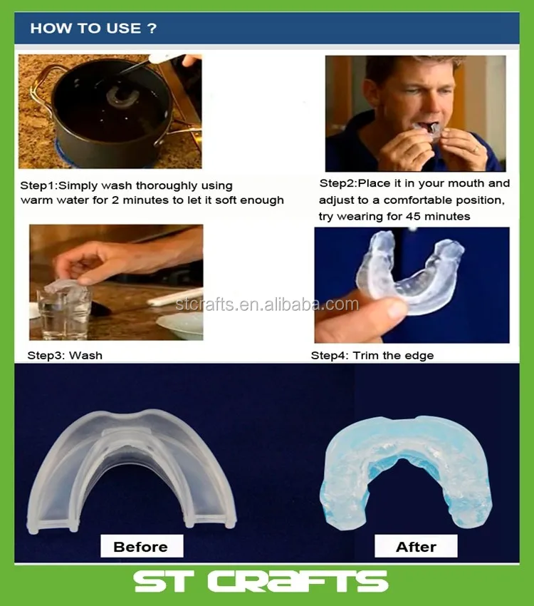 Sleep Aid Custom Mouthpiece Bpafree Nontoxic Best Bruxism Teeth
