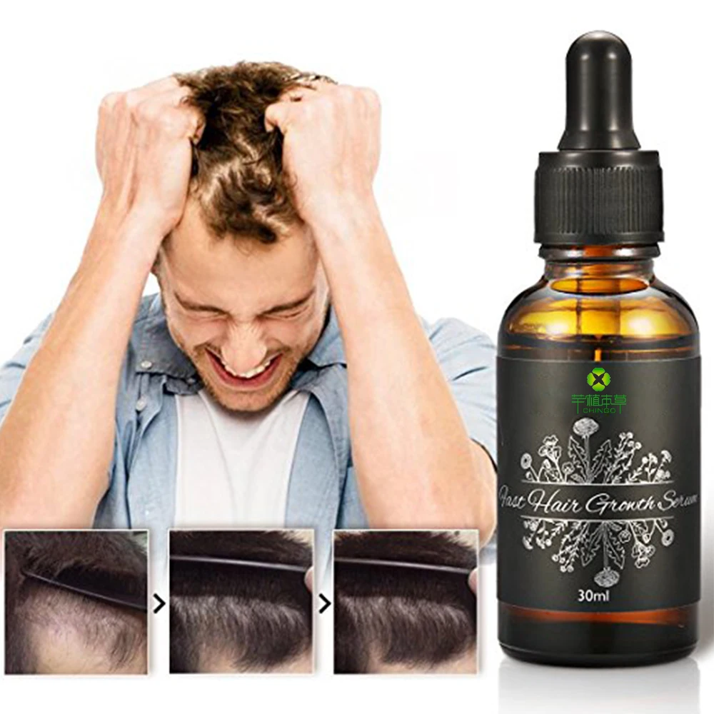 OEM/ODM nourishing & care hair hair loss serum for female & male