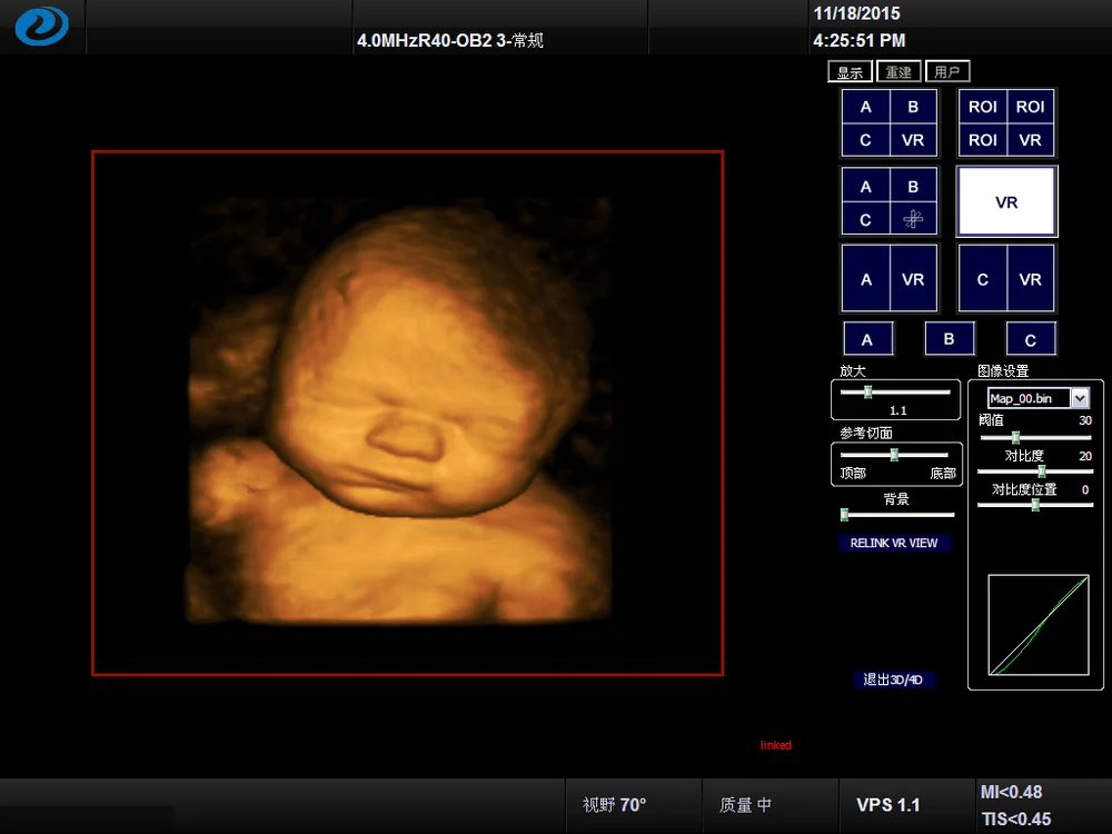 doppler ultrasound pregnancy machine