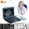 cheapest 3D vagina images laptop ultrasound price in China