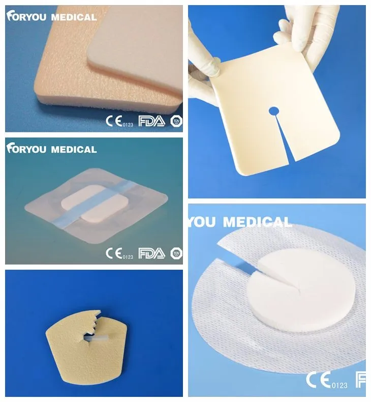 Medical Hydrogel Wound Dressing For Diabetic Foot / Pressure Ulcer