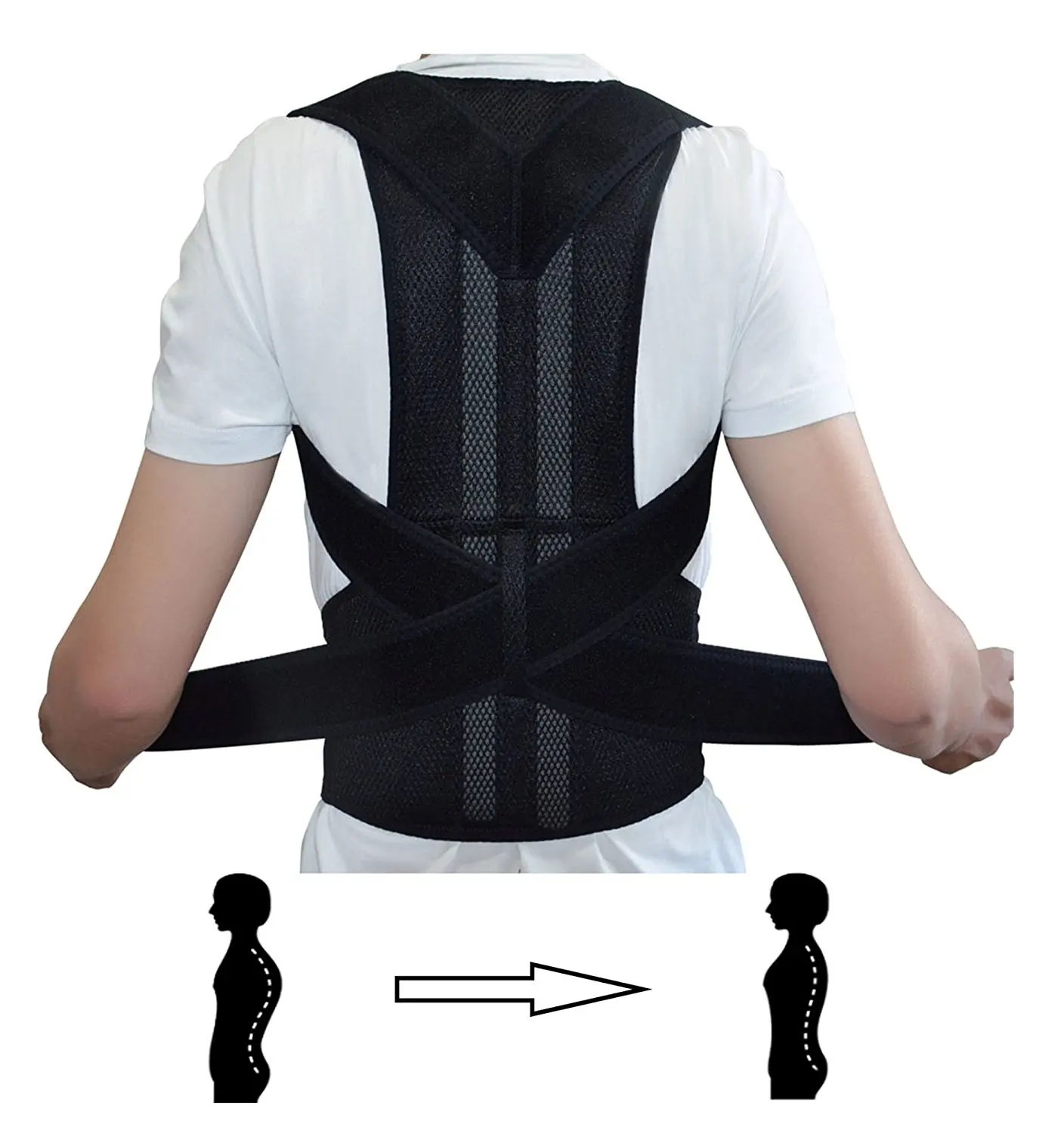 waist trainer and scoliosis