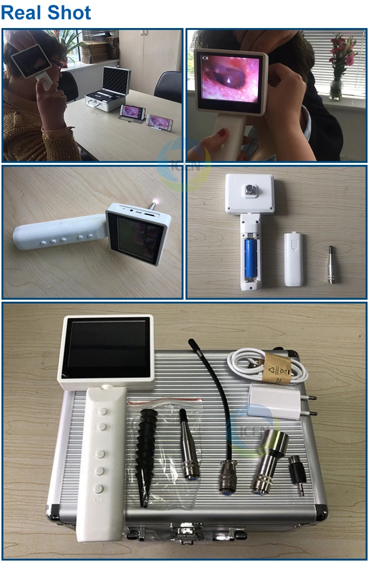 Ins1 Medical 3.5 Inch Screen Usb Otoscope Camera Wireless Wifi Ent