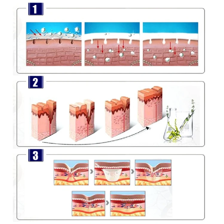 2018 Strongly Desalination Scar Skin Care Lavender Repair Essential Oil