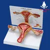 Anatomical uterus model