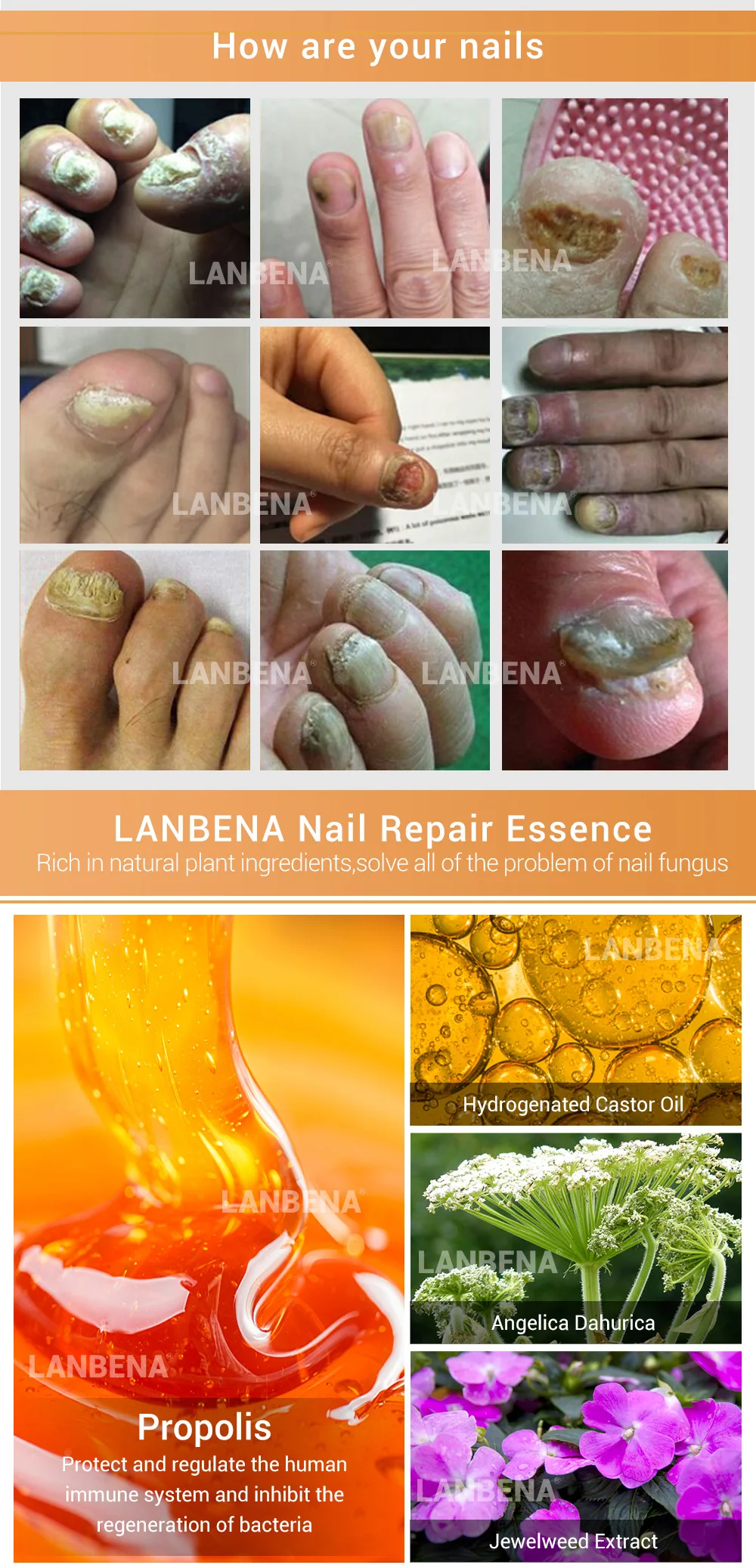 LANBENA Nail Care Gel Nail Foot Protector Skin Care Treatment Herb Nail Repair Essence