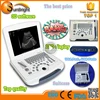 SUN-806G cheap PC Based 3D Laptop Ultrasound scanner