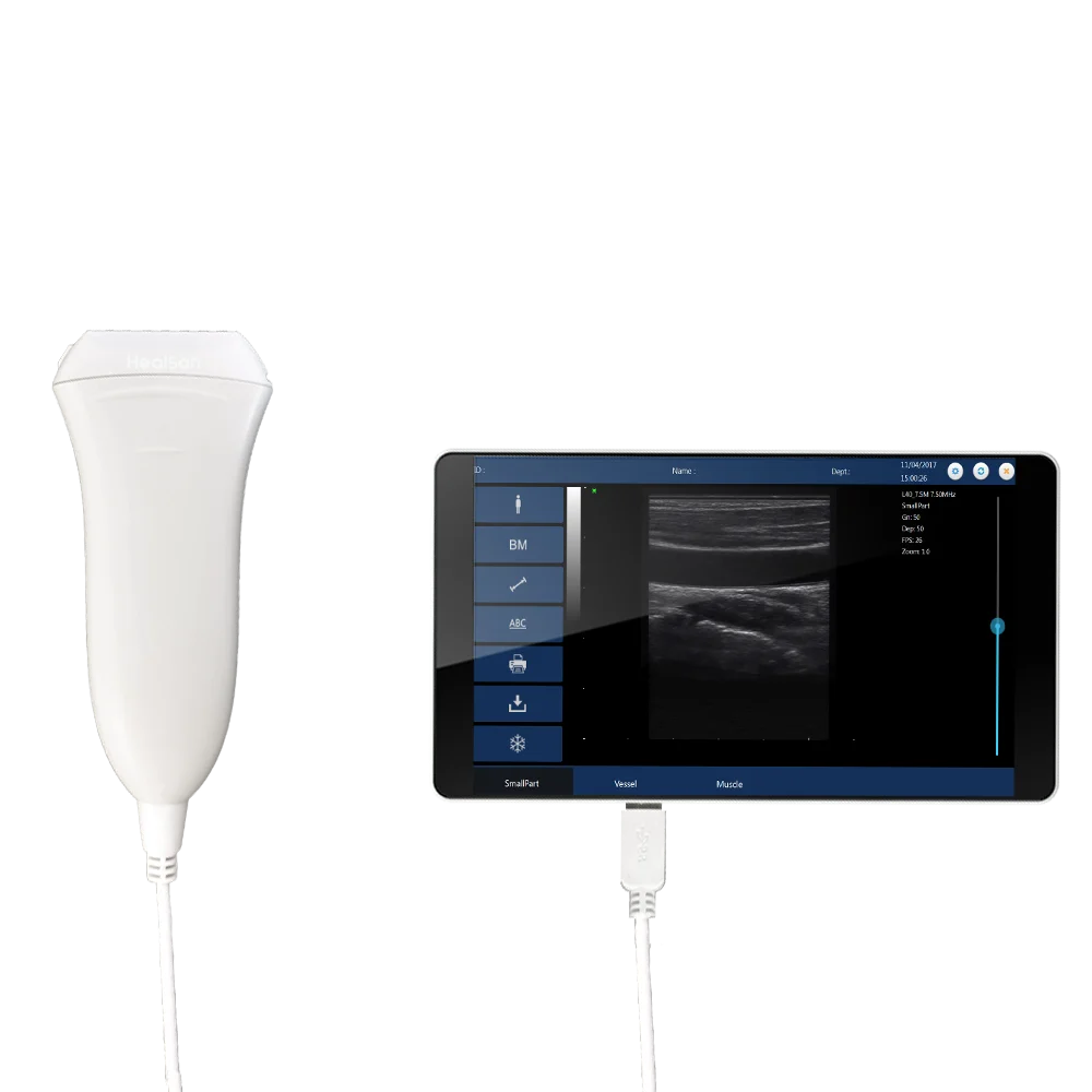 Healson U20l Usb 2d Handheld Portable Ultrasound Machine For Windows