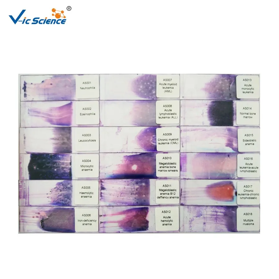 18pcs Glass Blood Smear Histology Human Microscope Biology Hematology