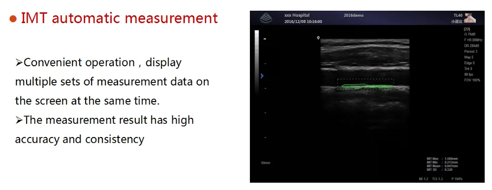 MT Medical Veterinary Ultrasound Machine
