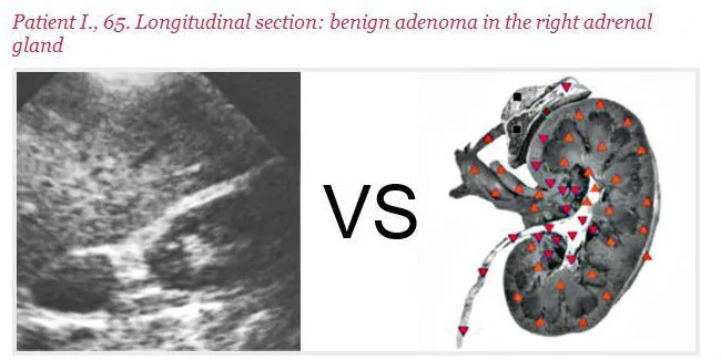 专业 8d nls 全身健康分析仪与生物树脂软件