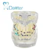 New design orthodontic model for showing four premolar extracted with bracket and ligature wire affixed
