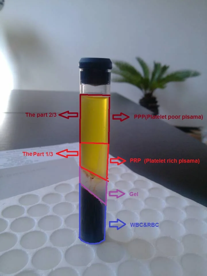 High Concentration Prp Tube With Upgrade Gel Buy Prp