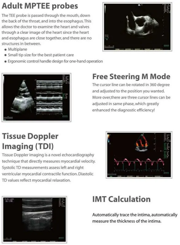 Cardiac Vascular doppler ultrasound