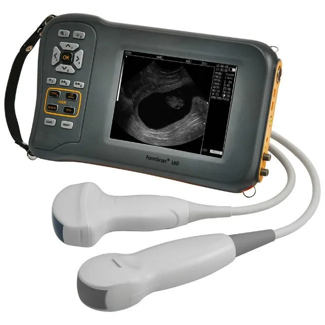 Fast and automatic ultrasound simulation from ct images Hand Held Ultrasound Machine For Livestock Farm Animals Bovine,Equine