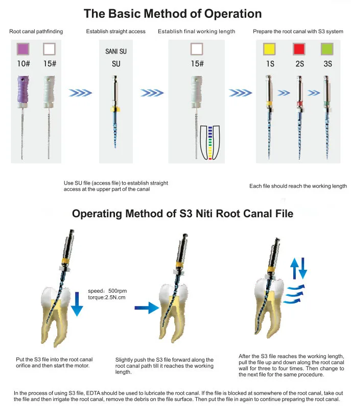 Niti S3 Dental Finishing Files Dental Endodontic File Buy Niti Files
