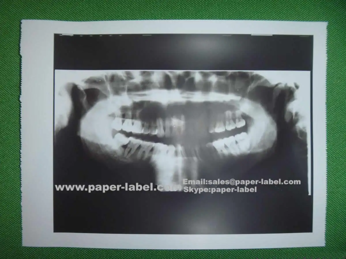 High light thermal printing paper use for hospital Sony UPP-110S/UPP-110HG