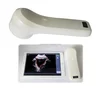4D Wireless Bladder Ultrasound Scanner Machine & Wireless Probe Scanner