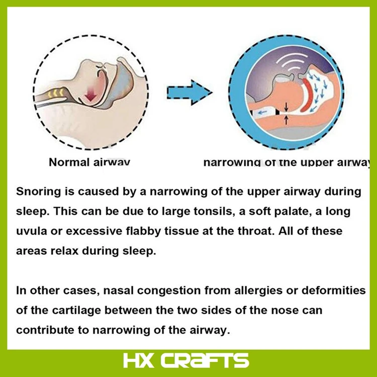 Anti Snoring Mouthpiece Tongue Retaining Device Snore Solution Sleep