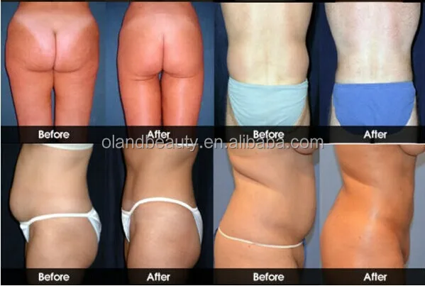 Supplements used to burn belly fat photo 9