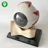The anatomical model of human eyeball is 5 times the size of the orbit around the eye.