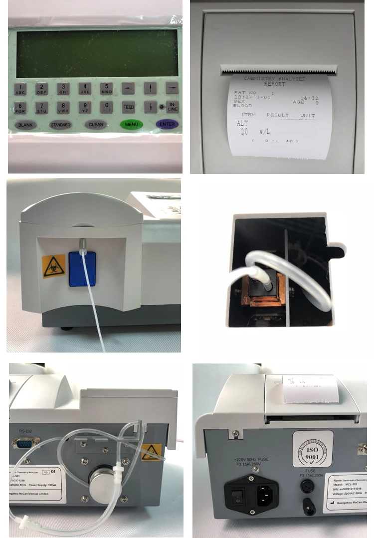 clinical human semi-automatic chemistry analyzer
