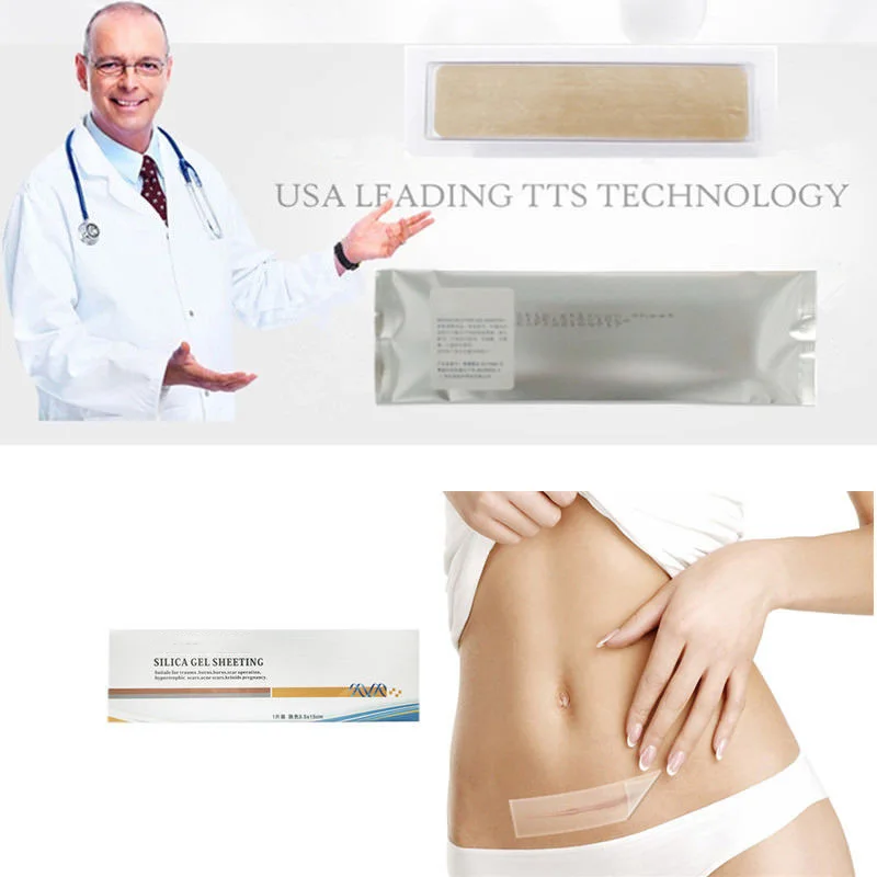 Online Products Health Care Products Silicone Scar Tape New Product Mark Patch Scar Removal Silicone Scar Sheet