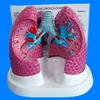 Bronchopulmonary Disease Pathological Lung Model
