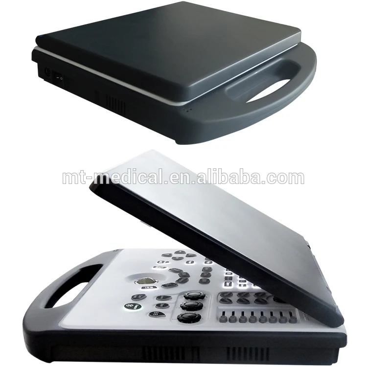 Portable 3D Doppler Ultrasound Machine Ultrasonography