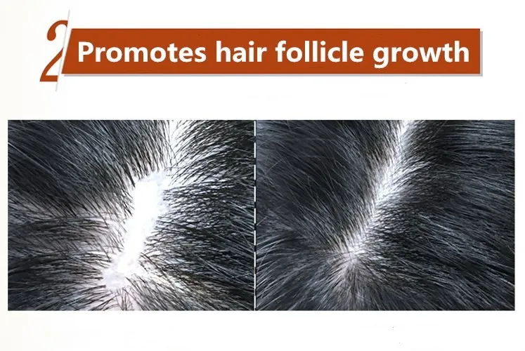 100 Guaranteed Fast Hair Growth Spray For Unisex Buy 100 Guaranteed Hair Growth,Fast Hair