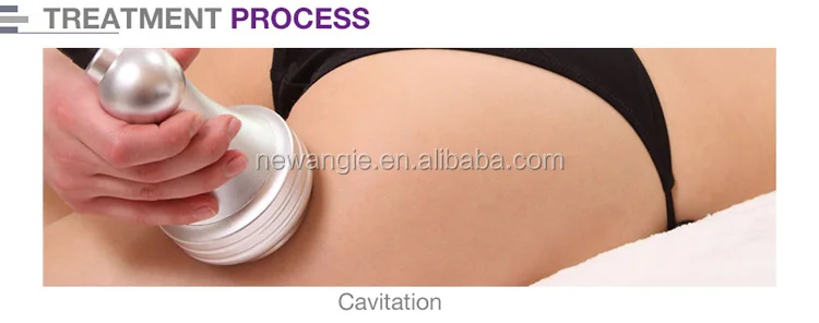 cavitation machine (5).jpg