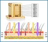 3 wave 755nm 808nm 1064nm micro channel cooling laser hair removal machine diode laser stack/green laser module