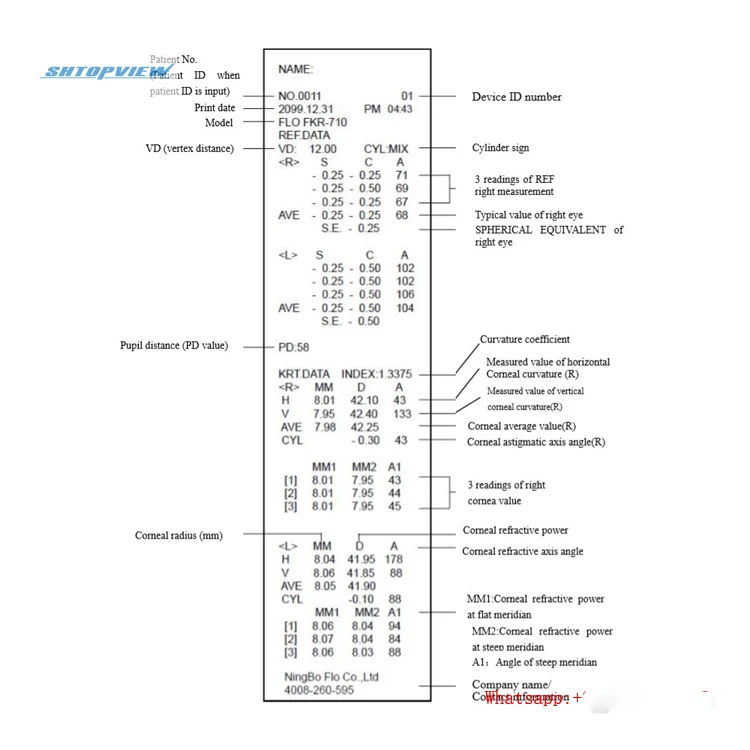 FKR-710 Auto Keratometer ophthalmic auto kerato refractometer keratometer