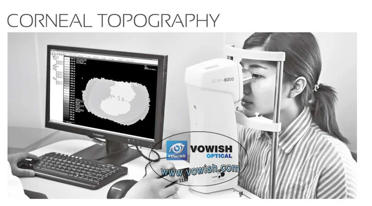 corneal topographer
