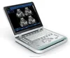 Two Colors of Ultrasound Scan machine with 3D software