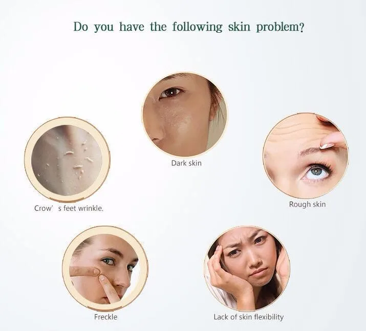 New beauty product black head removal instrument comedo suction device