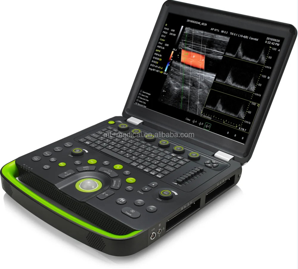 Portable Ultrasonic Diagnostic Devices Type Ultrasound Machine For Pregnancy