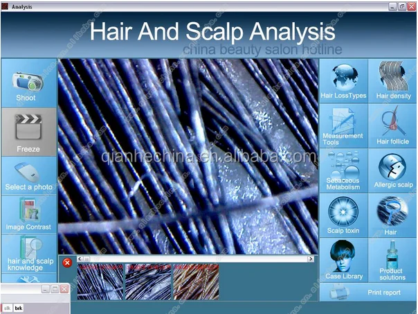 Beauty Center Use Hair Salon 200x Hair Density Test Machine - Buy Hair  Density Test Machine,200x Hair Density Test Machine,Hair Salon 200x Hair  Density Test Machine Product on 