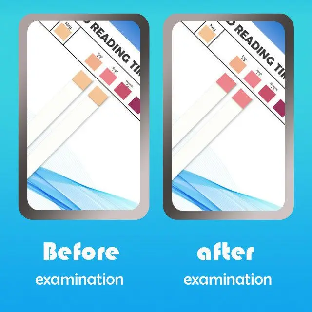 Ketone Rapid Test Kit Urs1k Amazon Hot Sale Ketone Strips With Ce Iso