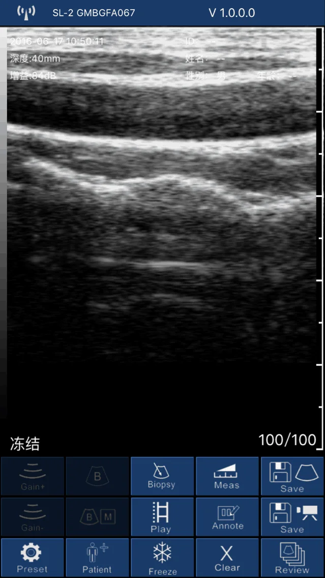 128 Elements Ipad Ultrasound Machine Linear Probe/usg Linear Ultrasound