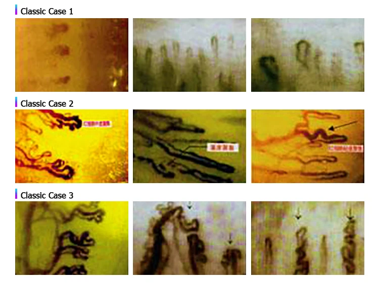 Nail Checking Microscope