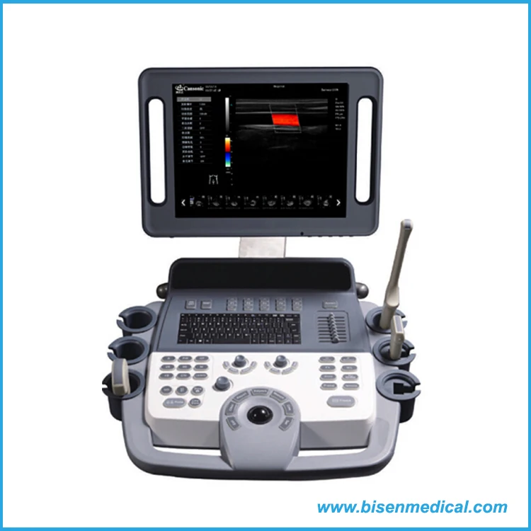 Multifrequency Advanced Medical Pregnancy Scanner Trolley 4d